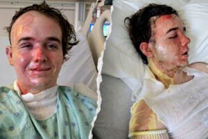 McDonald’s worker allegedly doused with hot cooking oil by co-worker, suffers burns over 22% of his body